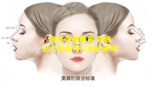 液体骨膜隆鼻 骨膜贴片隆鼻可以取出来吗